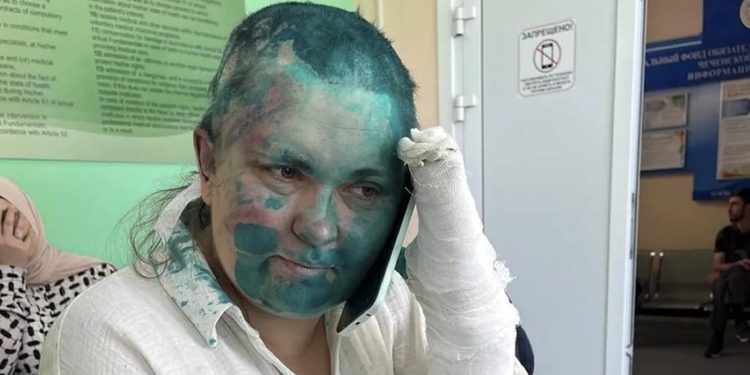 Solidarietà alla collega russa Yelena Milashina per le violenze e le inaudite umiliazioni subite